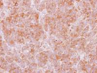 TRIM29 antibody [C1C3]