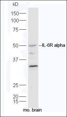 IL6 Receptor antibody