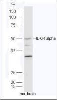 IL6 Receptor antibody