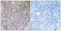 NDUFS7 antibody