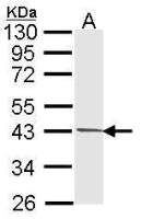 PIM2 antibody