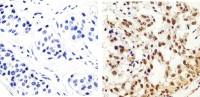 IRS1 (phospho Tyr896) antibody