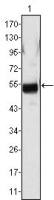 Fibrinogen beta antibody [1F9]