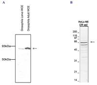 CDC73 antibody - ChIP grade