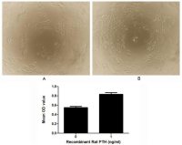 Rat Parathyroid Hormone protein, His and MBP tag (active)