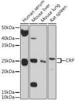 C Reactive Protein antibody