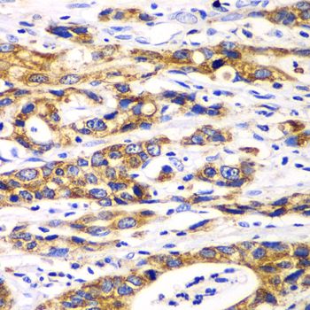 Ribophorin I antibody