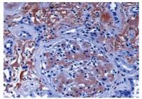 LECT2 antibody [4B24]