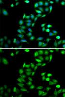 PDCD6 antibody