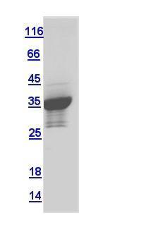 Drosophila CG1458 protein, GST tag