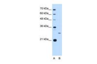 ASPH antibody, N-term