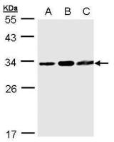 TATDN1 antibody [N1C2]