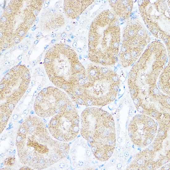 Sorbitol Dehydrogenase antibody