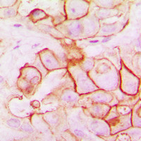 PMEPA1 antibody