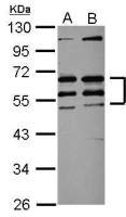 CREST antibody [N1C2]
