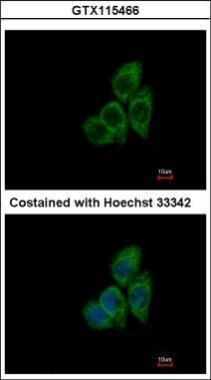 TCP1 theta antibody