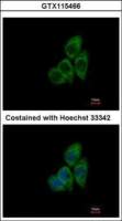 TCP1 theta antibody