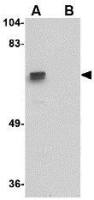 ZNF350 antibody