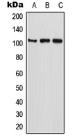 ETAA1 antibody