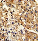 Sodium/Potassium ATPase beta 2 antibody, Internal