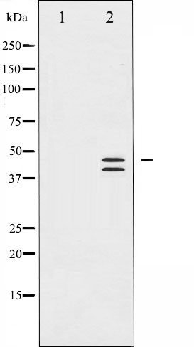 ERK1 (phospho Thr202) + ERK2 (phospho Thr185) antibody