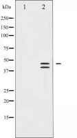ERK1 (phospho Thr202) + ERK2 (phospho Thr185) antibody