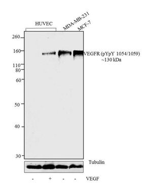 VEGF Receptor 2 (phospho Tyr1054/Tyr1059) antibody
