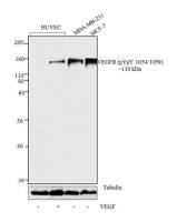 VEGF Receptor 2 (phospho Tyr1054/Tyr1059) antibody