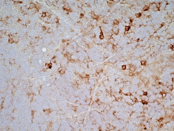 SIRP alpha antibody [OX-41]