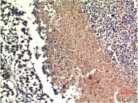 PTEN antibody [9E8]