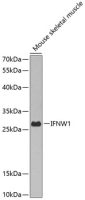 Interferon omega antibody