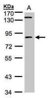 LIM kinase 2 antibody