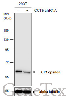 TCP1 epsilon antibody [N1C1]