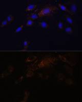 Proteasome 20S beta 7 antibody