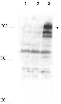 APC1 (phospho Ser355) antibody