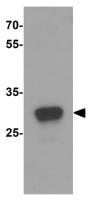 IL15 Receptor alpha antibody