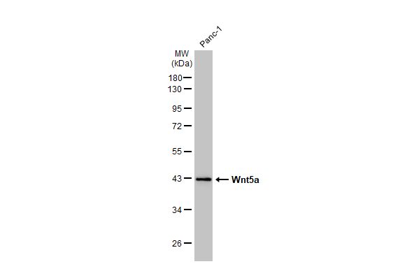 Wnt5a antibody