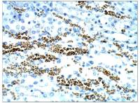 STRA6 antibody