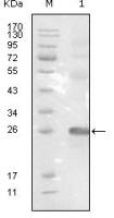 EphB3 antibody [4A122D1]