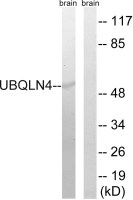 Ubiquilin 4 antibody