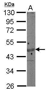Actin Gamma 1 antibody