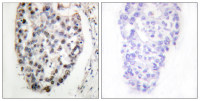 MYF5 antibody