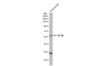 GLS2 antibody