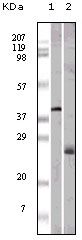 Apolipoprotein M antibody [10C3G5]