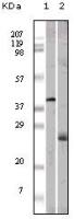 Apolipoprotein M antibody [10C3G5]