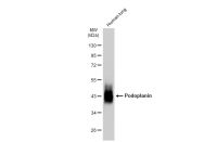 Podoplanin antibody [JM31-21]
