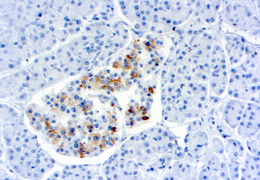 TIMP2 antibody [3A4]