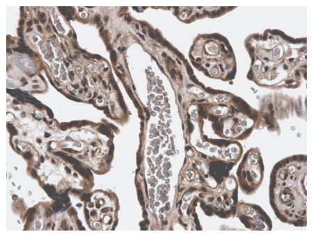 MMP3 antibody [3E44]