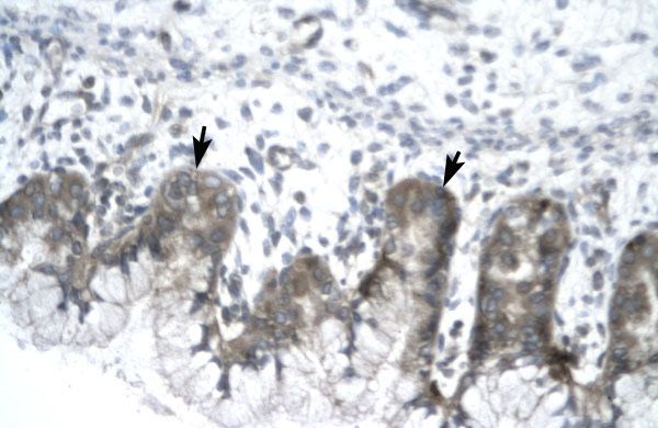 IVNS1ABP antibody, N-term
