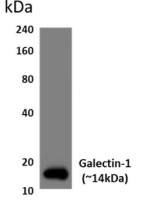 Galectin 1 antibody [9J26]